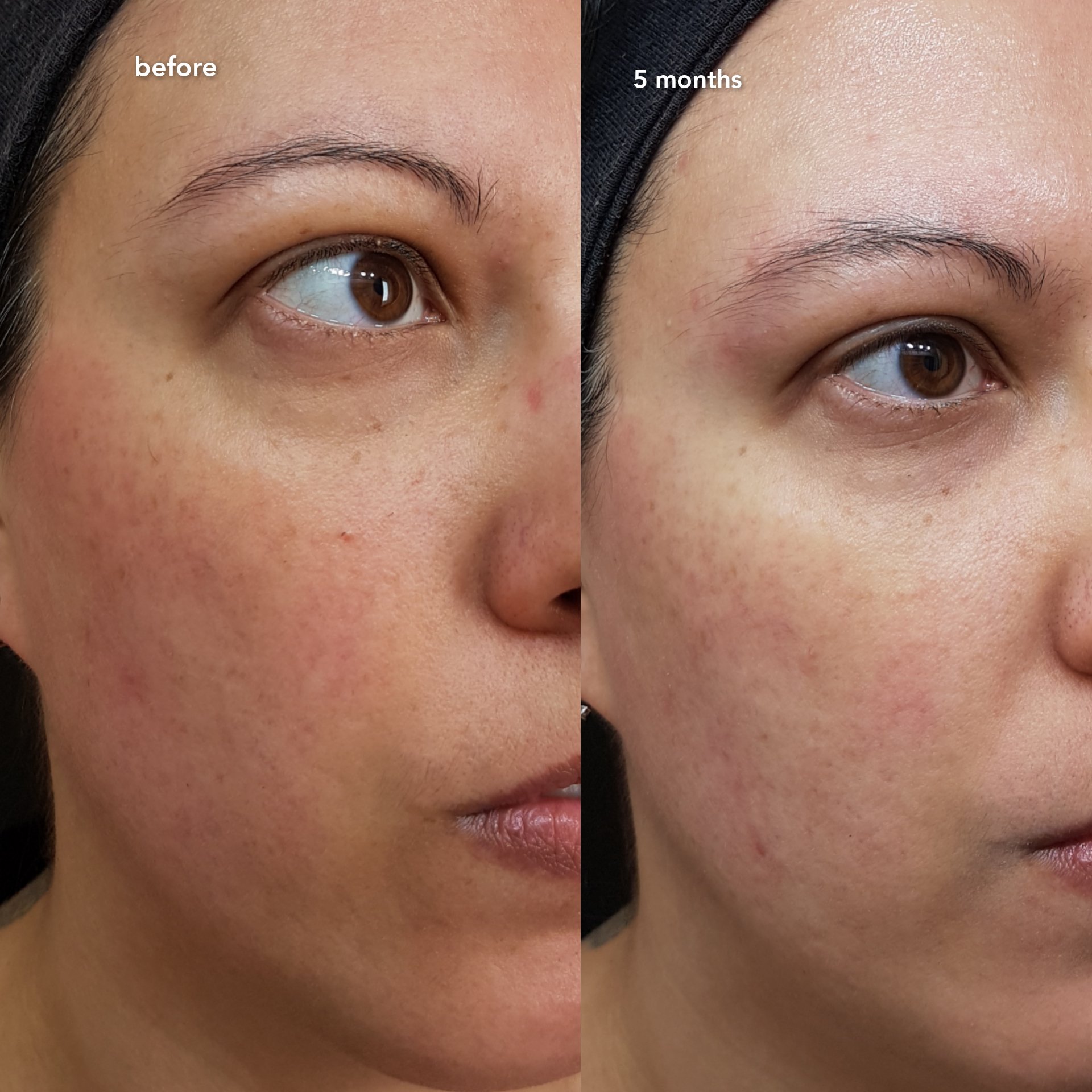 pt141 nasal spray reddit PT-141 Nose Spray: A New Peptide that Ignites Desire  The Berman Brief